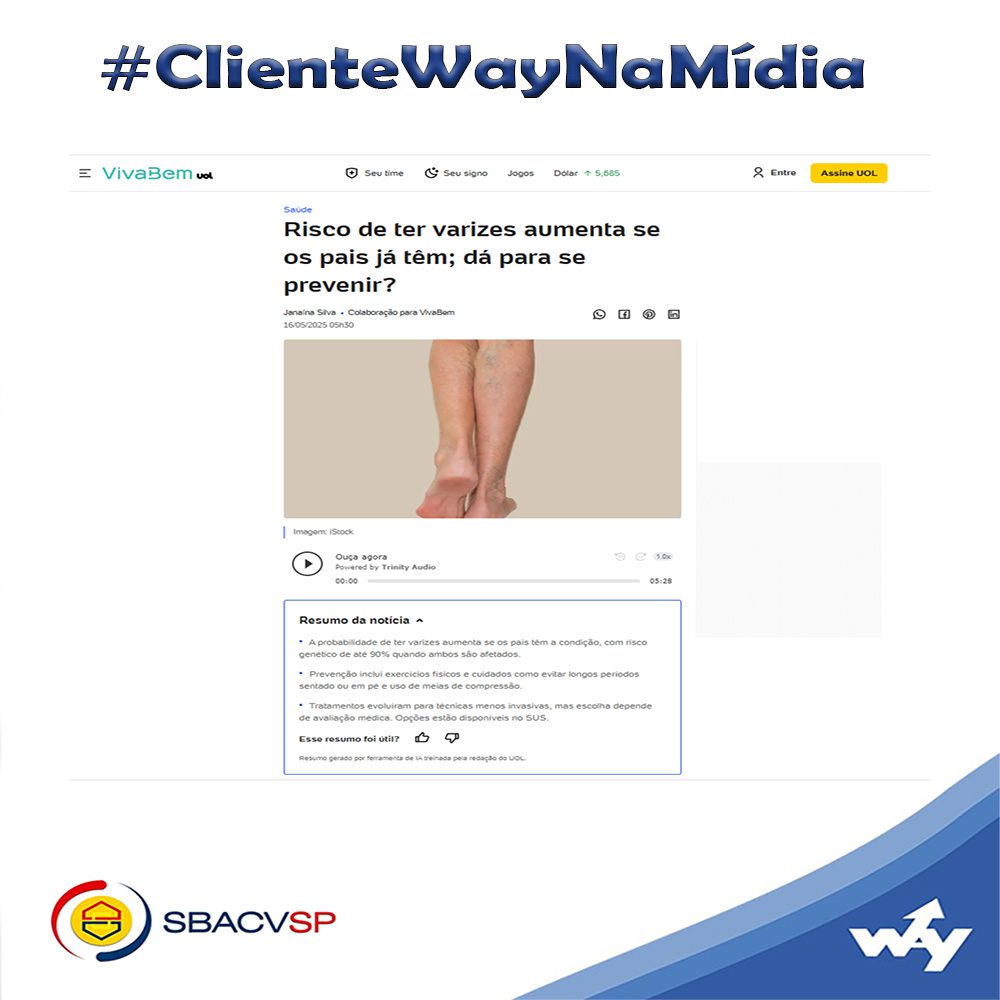 UOL / Viva Bem: Risco de ter varizes aumenta se os pais já têm; dá para se prevenir?
